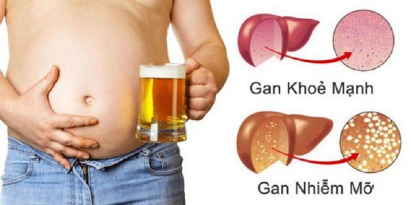 gan-nhiem-mo-vanhoadoanhnhan