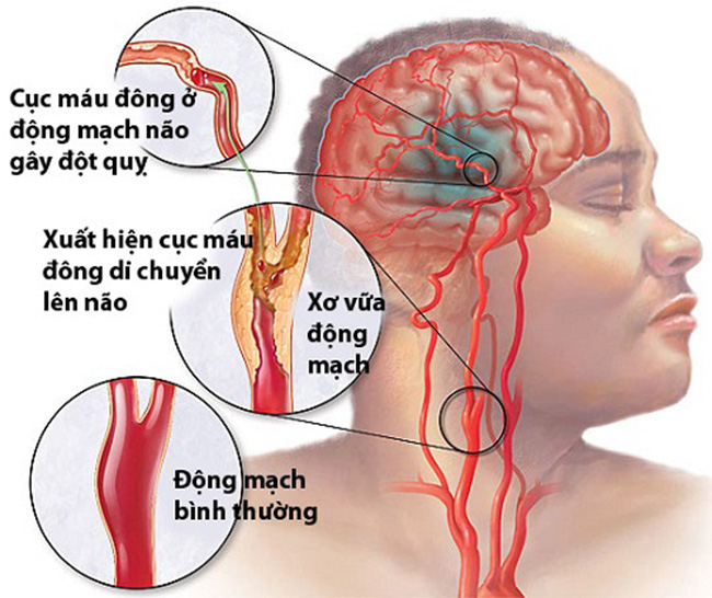 thuc-hu-viec-dung-kim-chich-dau-ngon-tay-so-cuu-nguoi-dot-quy-VHDN2