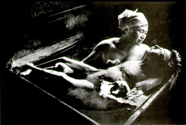 
Bệnh nhân mắc bệnh Minamata có các triệu chứng tê liệt, co giật đến tử vong.
